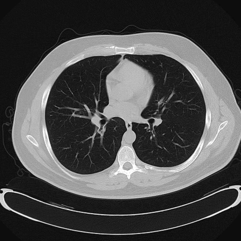 Illustrative axial chest CT showing both lungs; displayed annotations are fictional